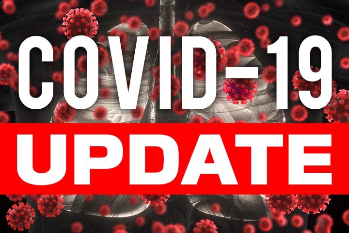 COVID-19 UPDATE: confirmed cases exceed 400, with 34 new cases